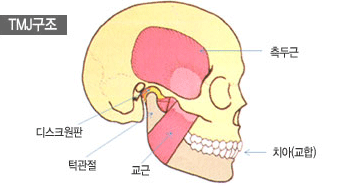 TMJ